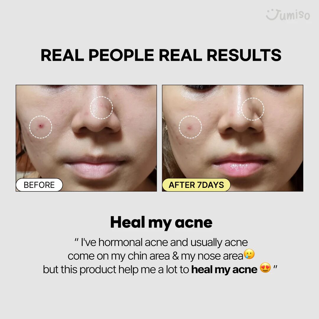 Jumiso Snail Mucin 95 + Peptide Essence - Imagen 6