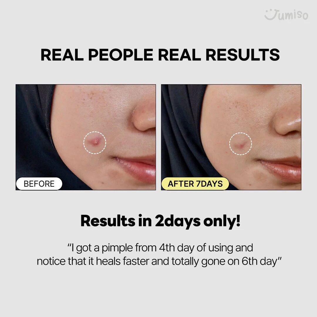 Jumiso Snail Mucin 95 + Peptide Essence - Imagen 8