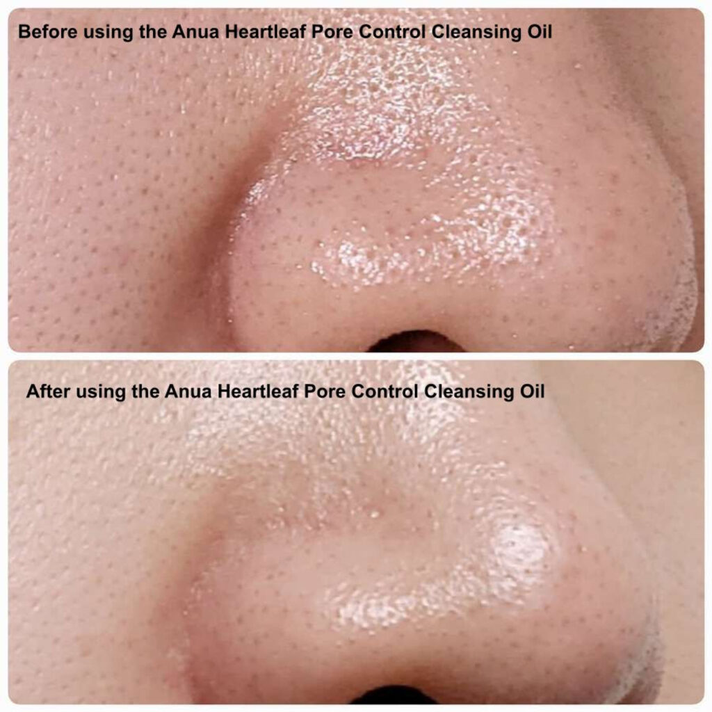aceite limpiador coreano heartleaf - doble limpieza poros