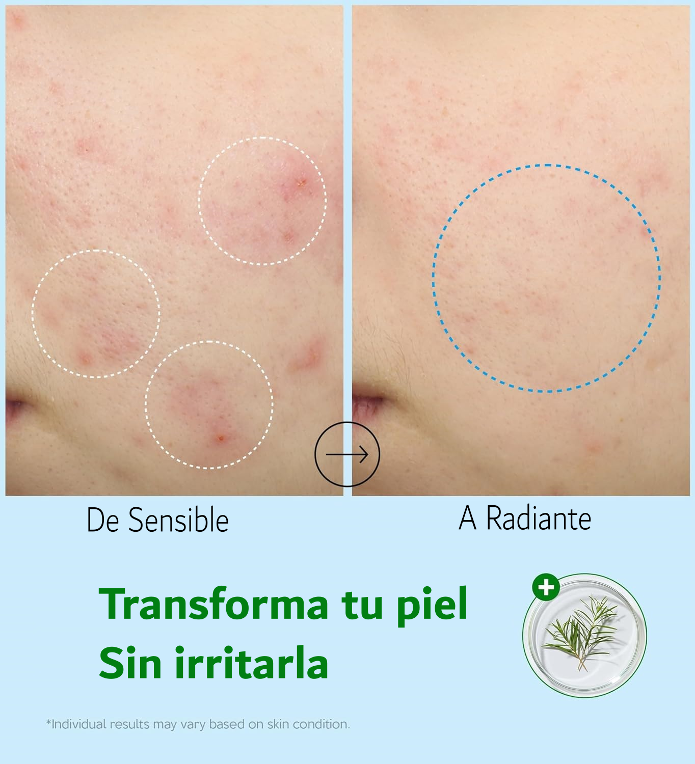 Aplicación crema Troubless - Hidratación facial intensa