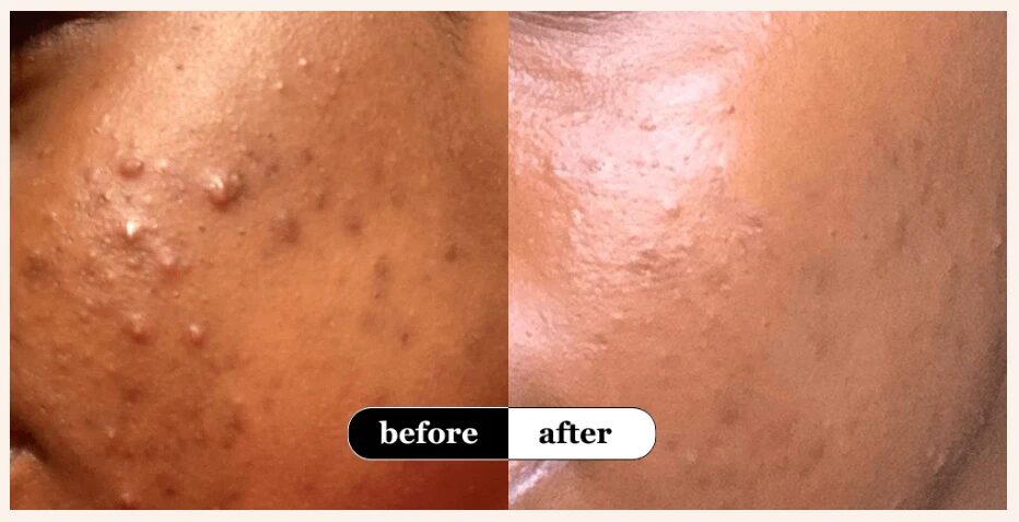 Detalle de producto Skincare Coreano Beauty of Joseon - Foto 4