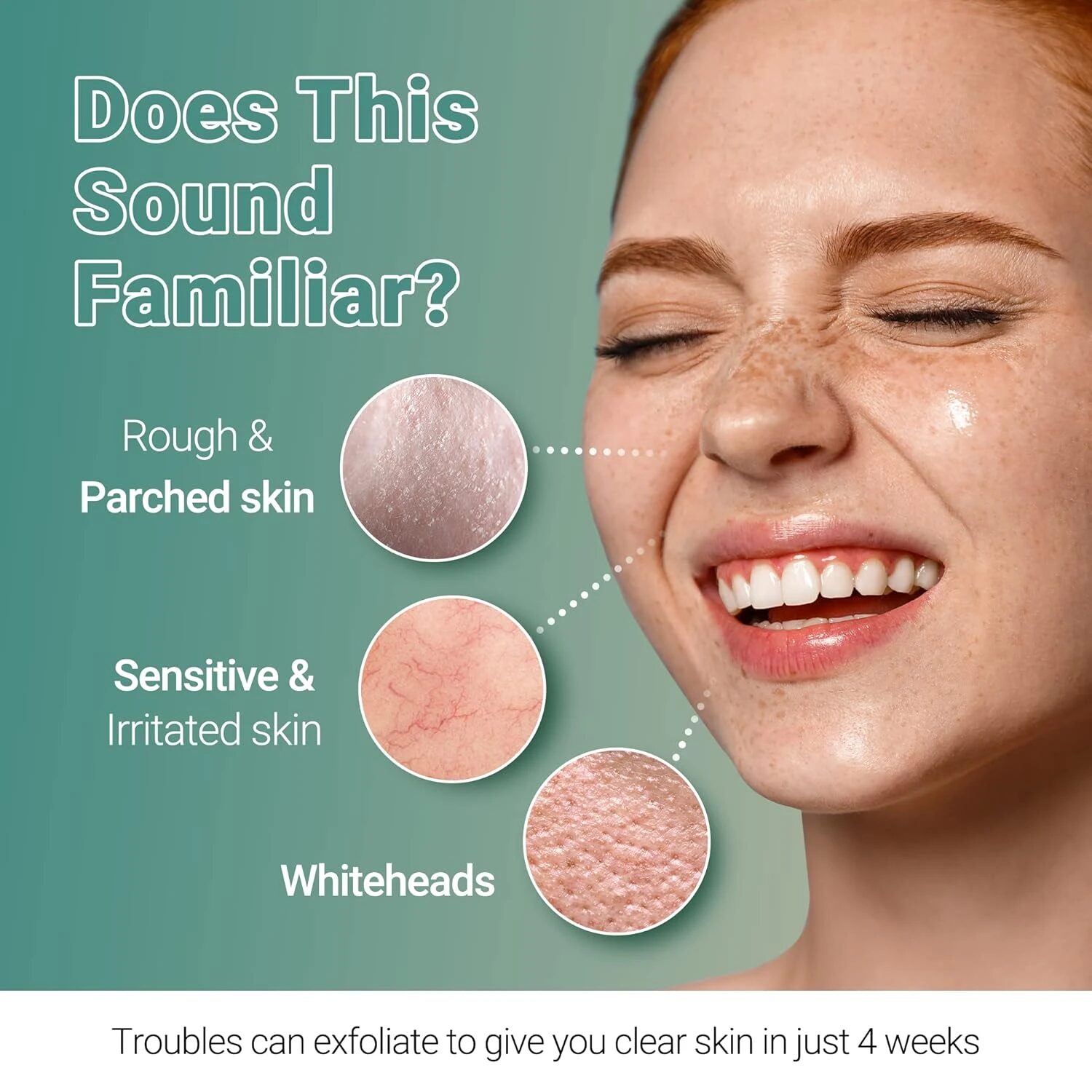 Detalle de producto Skincare Coreano Troubless - Foto 15