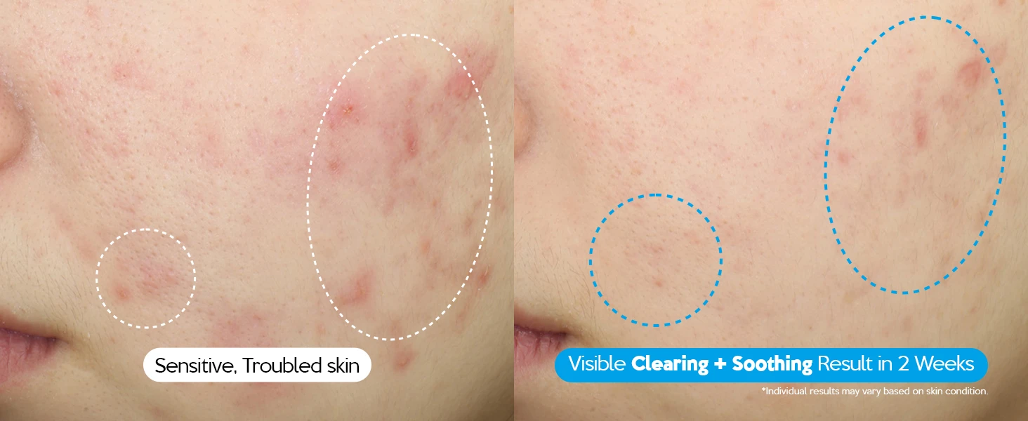 Hydro Soothing Moisture Cream - Modo de uso e ingredientes