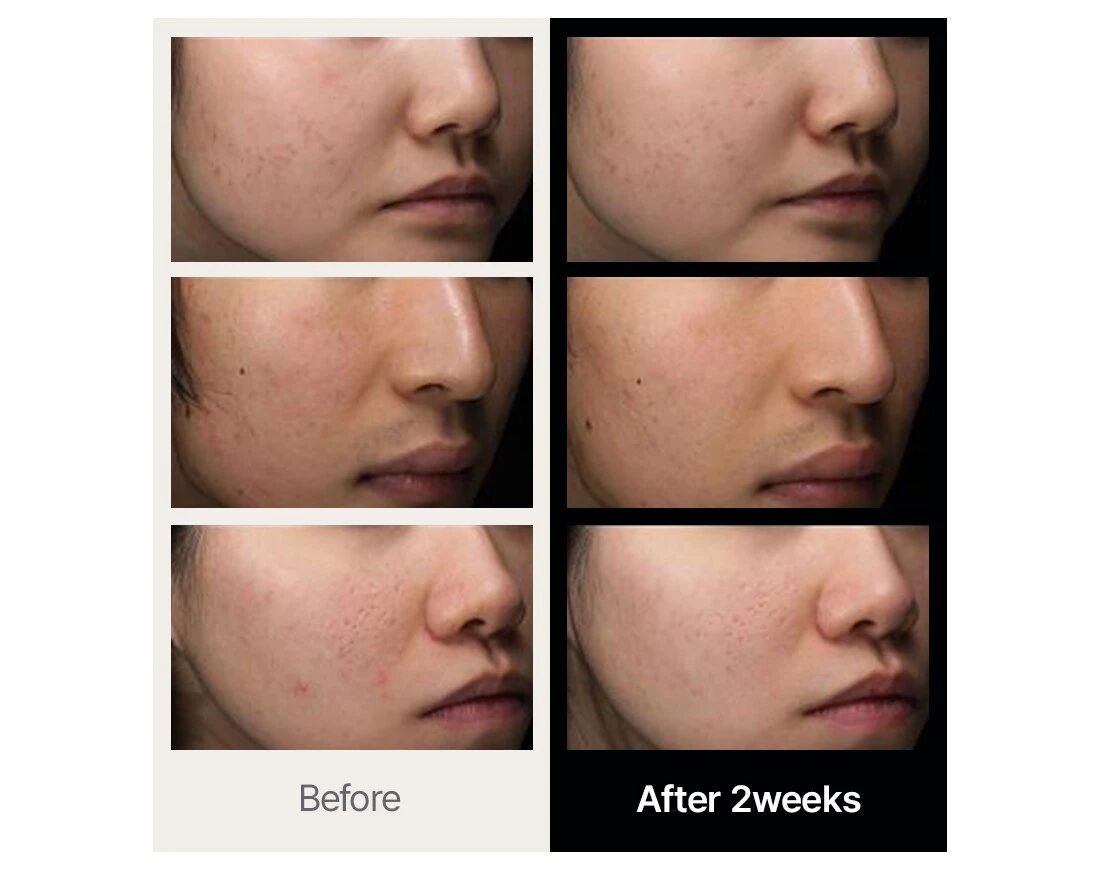 Detalle de producto Skincare Coreano Dr.Althea - Foto 4