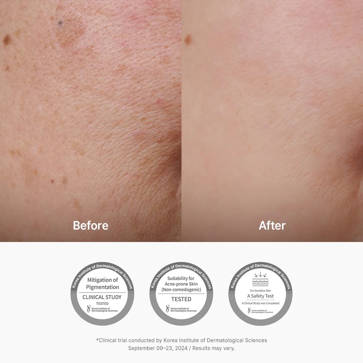 Detalle de producto Skincare Coreano Dr.Althea - Foto 5