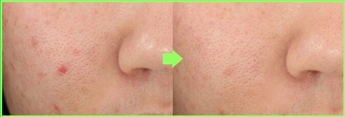 Clear Gel Cream - Modo de uso e ingredientes